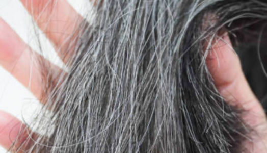 Ako sa starať o šedivé vlasy v lete